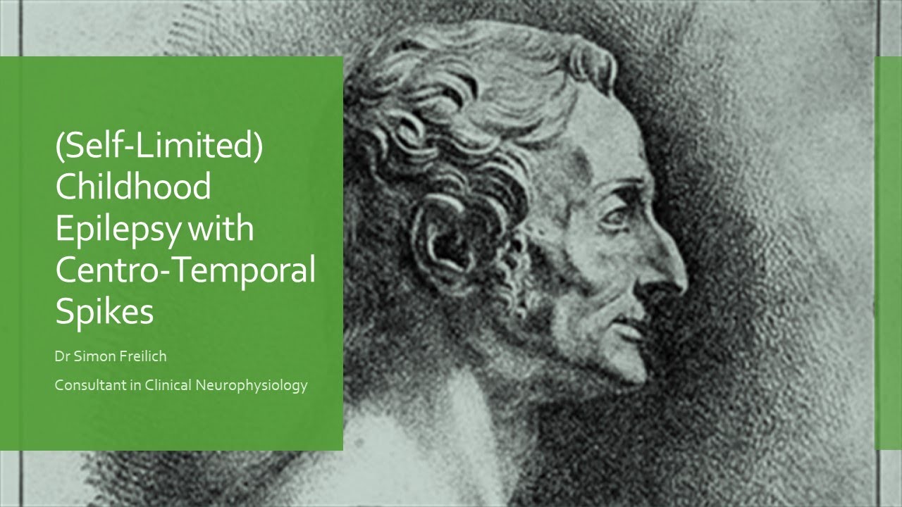 Childhood Epilepsy with Centro Temporal Spikes (Originally Rolandic Epilepsy)