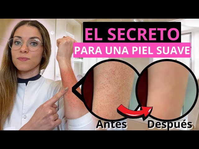Vídeo relacionado con Gel Exfoliante Corporal Kp Bump Eraser para Queratosis Pilaris, Piernas de Fresa con ácido Salicílico AHA, Exfoliante Kp para Piel de Gallina, Zona del Bikini y los Glúteos con Esponja Vegetal Unisexo