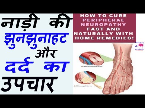 Peripheral Neuropathy Natural Treatment | How to Relieve Peripheral Neuropathy By- Dr.Vishal PT Video
