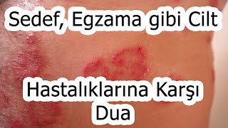 Sedef, Egzama, Mantar gibi Cilt Hastalıklarına Karşı Dua