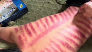 Download lagu Cạo gió danh nguyễn kerokan mp3