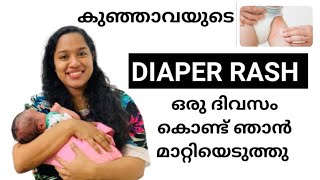 💯😱Magical Remedy For Diaper rash-Within a day You will see the result💯
