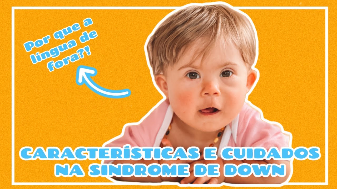 QUAIS SÃO AS CARACTERÍSTICAS DE PESSOAS COM SÍNDROME DE DOWN?
