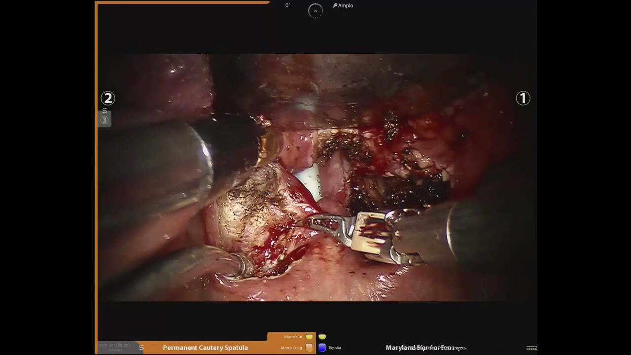 Adriano Santana Fonseca-14