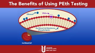 The Benefits of Using PEth Testing