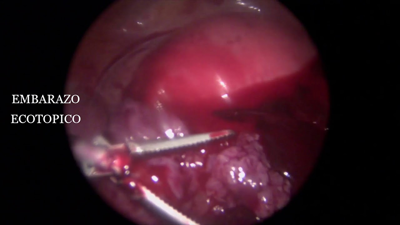 Fernando Lagunas Delgado-15