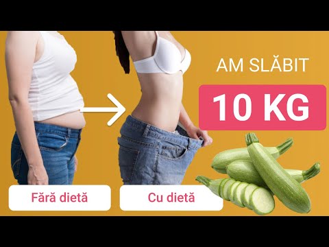 bai de radon în tratamentul varicozei varicoza i contraceptiva