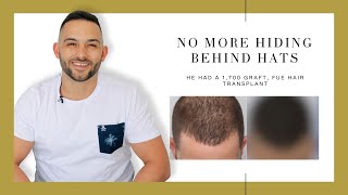 Canadian Hair Transplant Centre