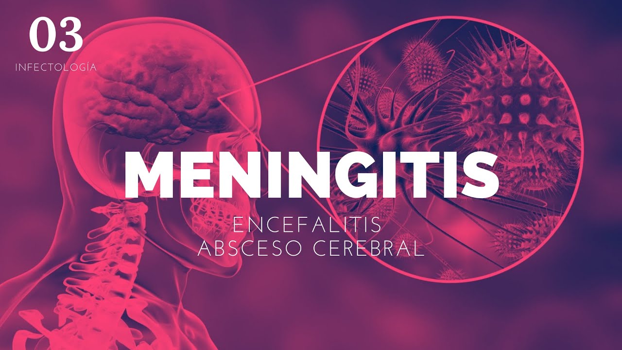 MENINGITIS/ENCEFALITIS/ABSCESO CEREBRAL - ENARM