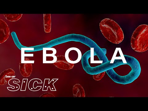 第二の最悪のエボラ出血熱の発生が間もなく終わるかもしれない理由 (Why the Second Worst Ebola Outbreak May Soon Be Over)