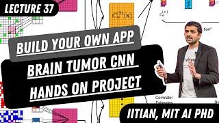 Build your own brain tumor classification CNN application in Python