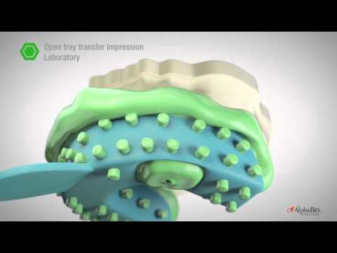 How to take open/ close tray impression? | Alpha-Bio Tec.