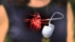 Defibrillator-Pacemaker: What&#39;s the Difference?
