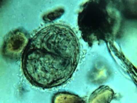 Lanalisi su helminths di battute di entrata Medicina da bambini contro vermi