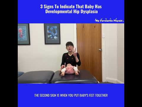 🔥🔥🔥 3 Signs To Indicate That Baby👶🏻 Has Developmental Hip Dysplasia
