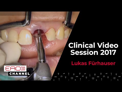 Lukas Fürhauser / Clinical Video Session 2017