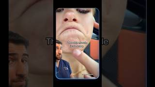 POV: You Just Saw Your Chin Muscle