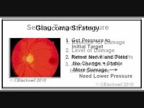 Jaskra cz.2 - leczenie