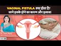 Vaginal Fistula क्या है जाने इसके होने के कारण ल�