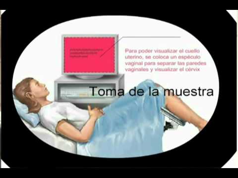 18/08/12 Toma de muestra de citología. 18/08/12 Toma de muestra de citología.
