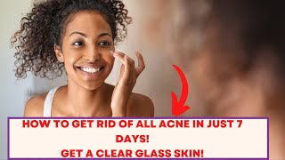 The Sudden Rise of AVC To Clear All Kinds Of Acne In Just 7 days!