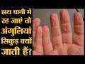 आपकी अंगुली सिकुड़ गई है तो भी डरने की �