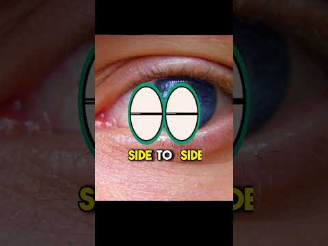 Truths About the HGN DWI Eye Test Revealed!