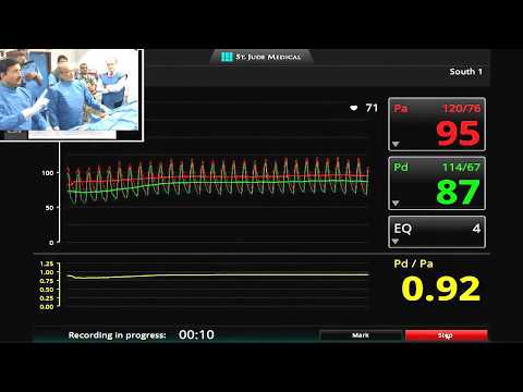 PCI of LMCA Bifurcation Stenosis & FFR evaluation of LAD Lesion