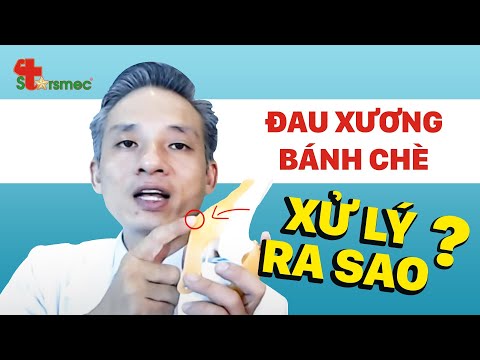 Đau Mặt Trước Gối - Đau đầu gối khi lên cầu thang | Bác sĩ Thể thao Nguyễn Trọng Thuỷ