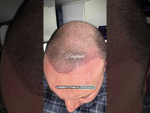 Testimonio Luis Gonzalo