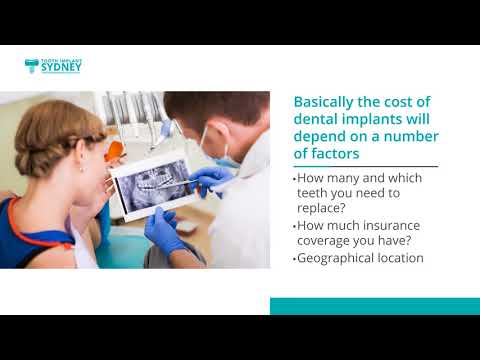 Dental Implants Cost in Sydney - Tooth Implant Sydney