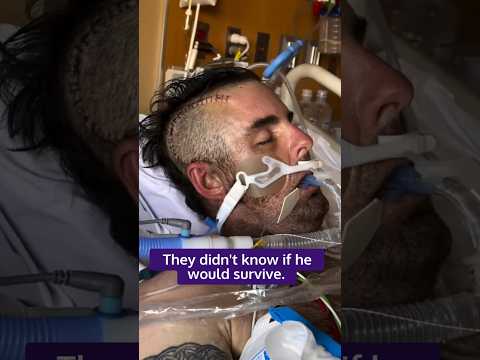 Logan had one of the biggest strokes ever seen