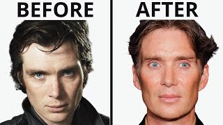 Cillian Murphy: All Natural | Plastic Surgery Analysis