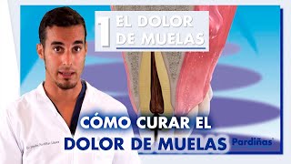 Cómo quitar el DOLOR DE MUELAS - Causas y tratamiento / #Shorts