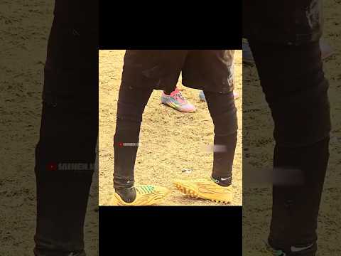 Never judge a player by his disability —judge him by his heart on the pitch. ⚽💪#football  #respect