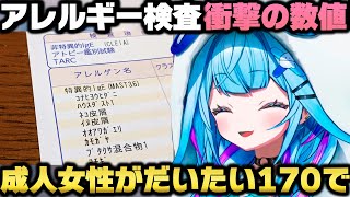 39種類アレルギー検査をした結果凄まじい数値が出て年中花粉症が確定する水宮枢ｗ【ホロライブ切り抜き】