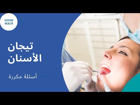 الأسئلة المتداولة حول تاج الأسنان
