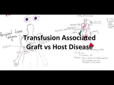 Transfusion Associated Graft Verses Host Disease - TA-RVHD