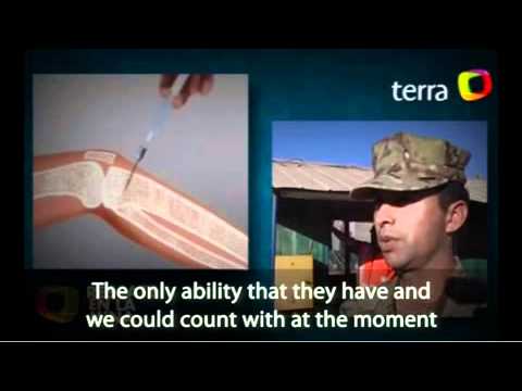 Chilean Miners use Bone Injection Gun IO device.