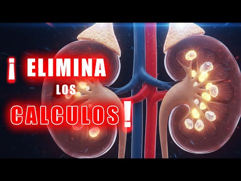 ELIMINA los CÁLCULOS RENALES con este REMEDIO CASERO, NATURAL