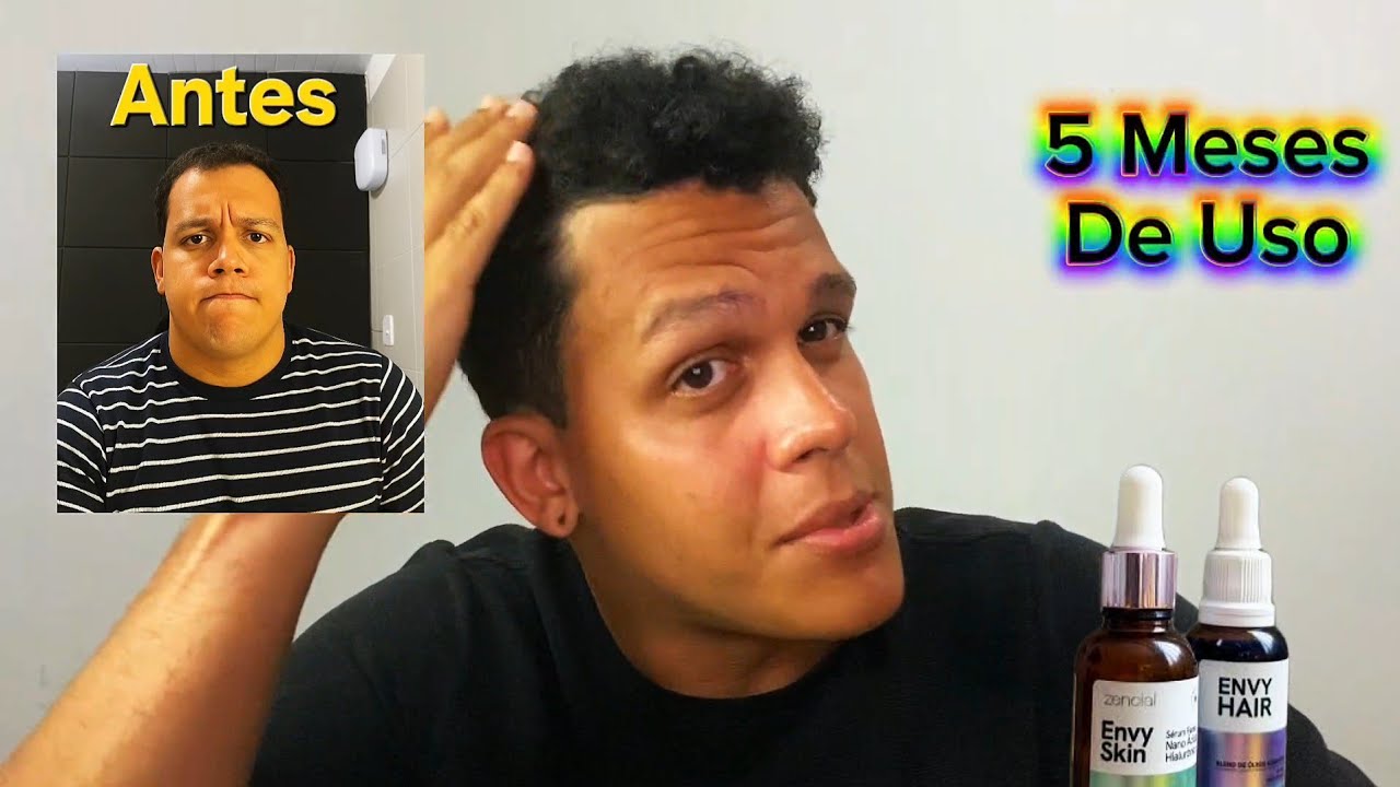 Envy Hair Funciona? Envy Hair Serum de Crescimento Calvície? Envy Hair Antes e Depois? Óleo Capilar?