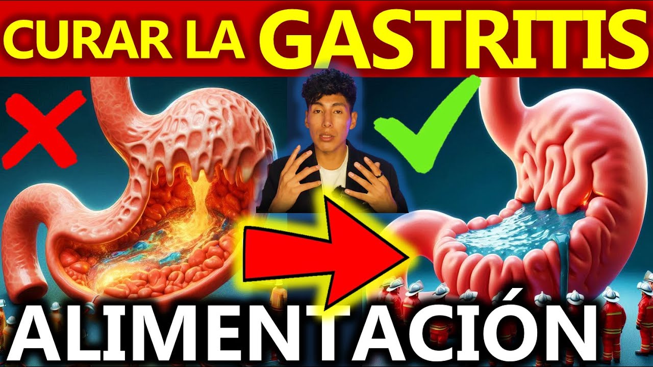 COMO CURAR LA GASTRITIS SIN MEDICAMENTOS | GuiaMed