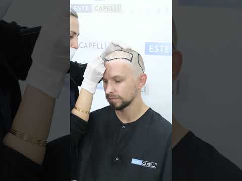 Patient video