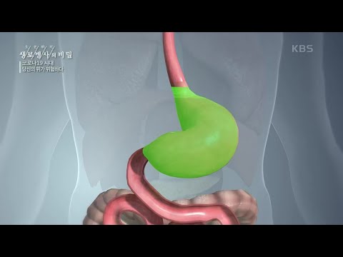, title : '오랜 통증과 소화불량의 원인 [생로병사의 비밀] | KBS 201111 방송'