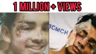 SteeveJosephAfter Accident Heart touching Video❤