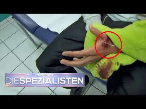 Die Schuppenflechte auf der Haut die Braunen Als das Ekzem auf den Ohren beim Kind zu behandeln