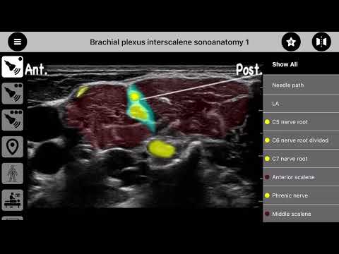 AnSo Anaesthesia Sonoanatomy