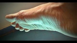 Hekla lava bei Fersensporn, Anwendung und Wirkung