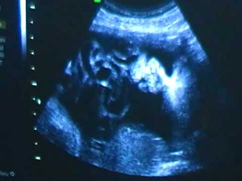 Ecografia del Simferopol ginocchio Unguento gel con dolore alle articolazioni e ai muscoli