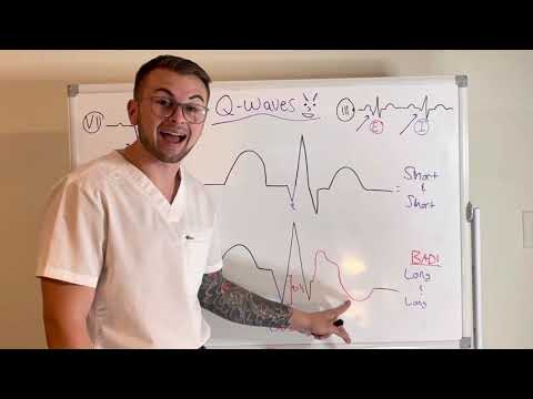 EKG Series: Q Waves (Respiratory Variation and Pathological Q Waves)